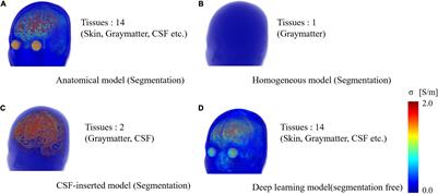 High-Resolution EEG Source Localization in Segmentation-Free Head Models Based on Finite-Difference Method and Matching Pursuit Algorithm